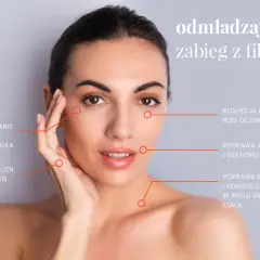 Kobieta z zaznaczonymi obszarami na twarzy, wskazującymi na odmładzający zabieg z fibryną bogatopłytkową.